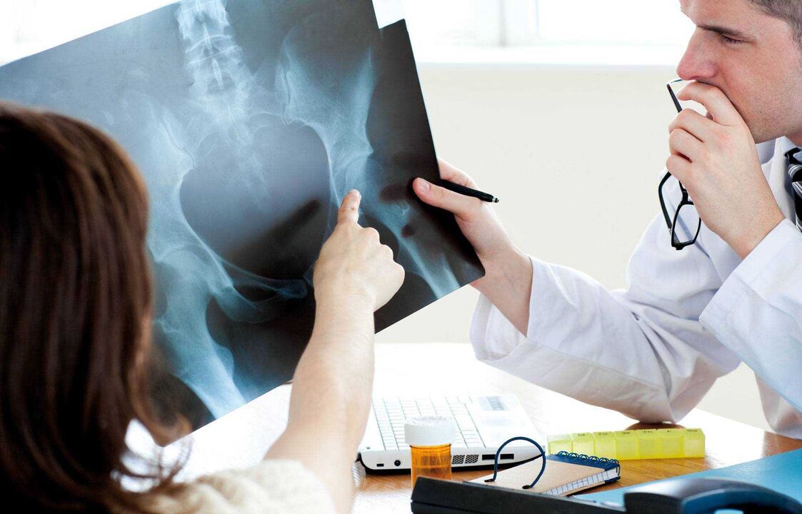 medici che esaminano i raggi X per l'artrosi dell'anca