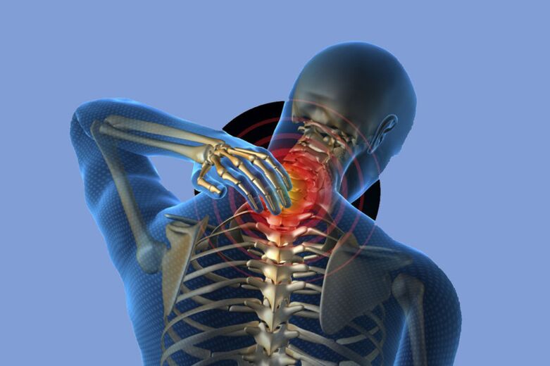 Dolore al collo nell'osteocondrosi